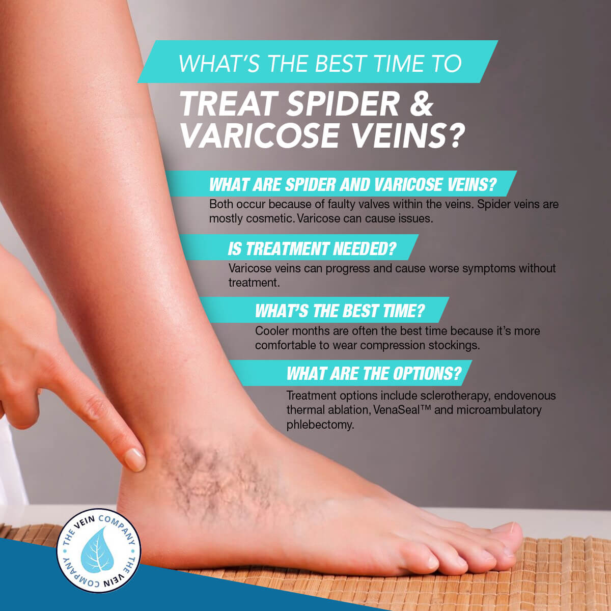 What's The Best Time To Treat Spider & Varicose Veins? [Infographic] - The  Vein Company